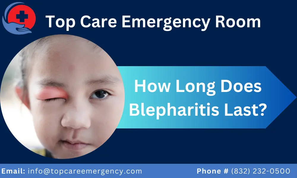 How Long Does Blepharitis Last?