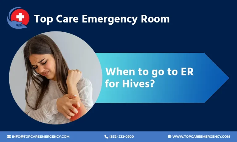 When to Go to ER for Hives