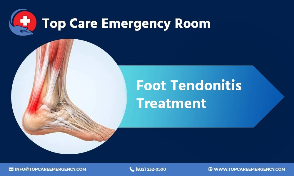 Foot Tendonitis Treatment & Symptons