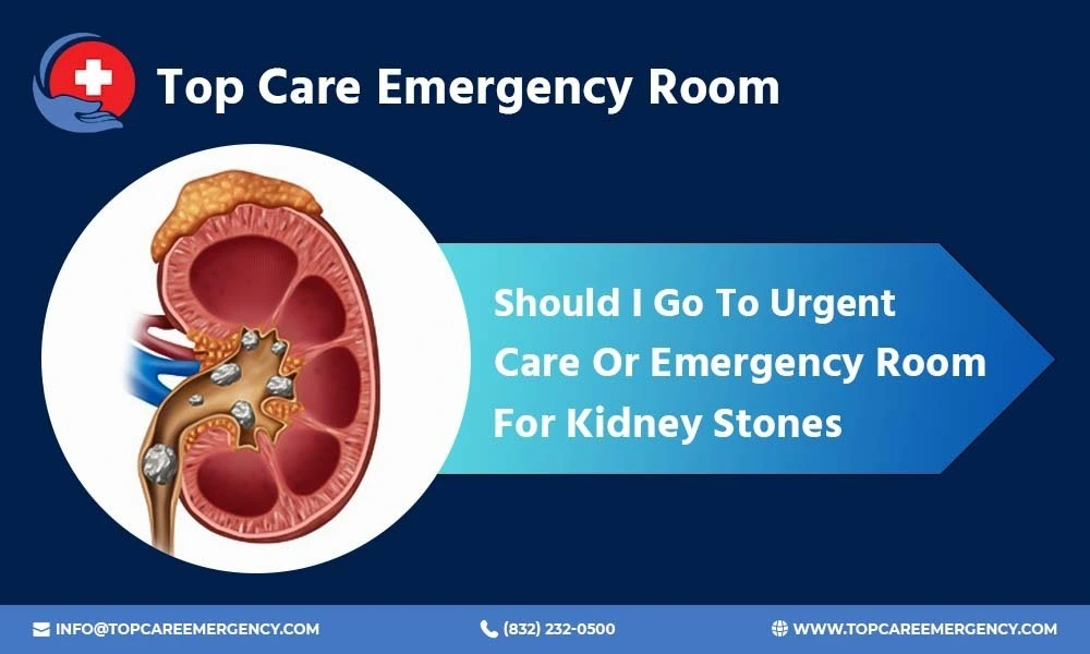 Emergency care for kidney stones: kidney cross-section showing when to choose urgent care or the emergency room.