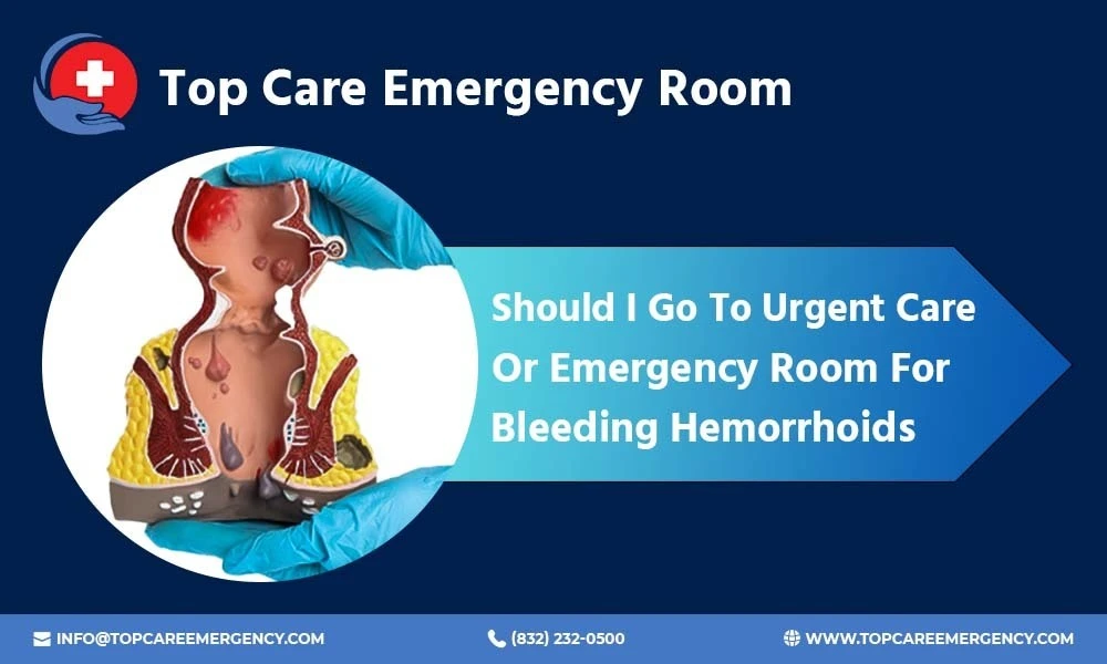 urgent care or emergency room for bleeding hemorrhoids